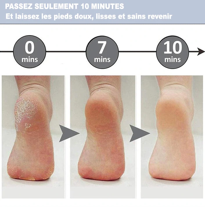 Lime à Pied Électrique Tafinet